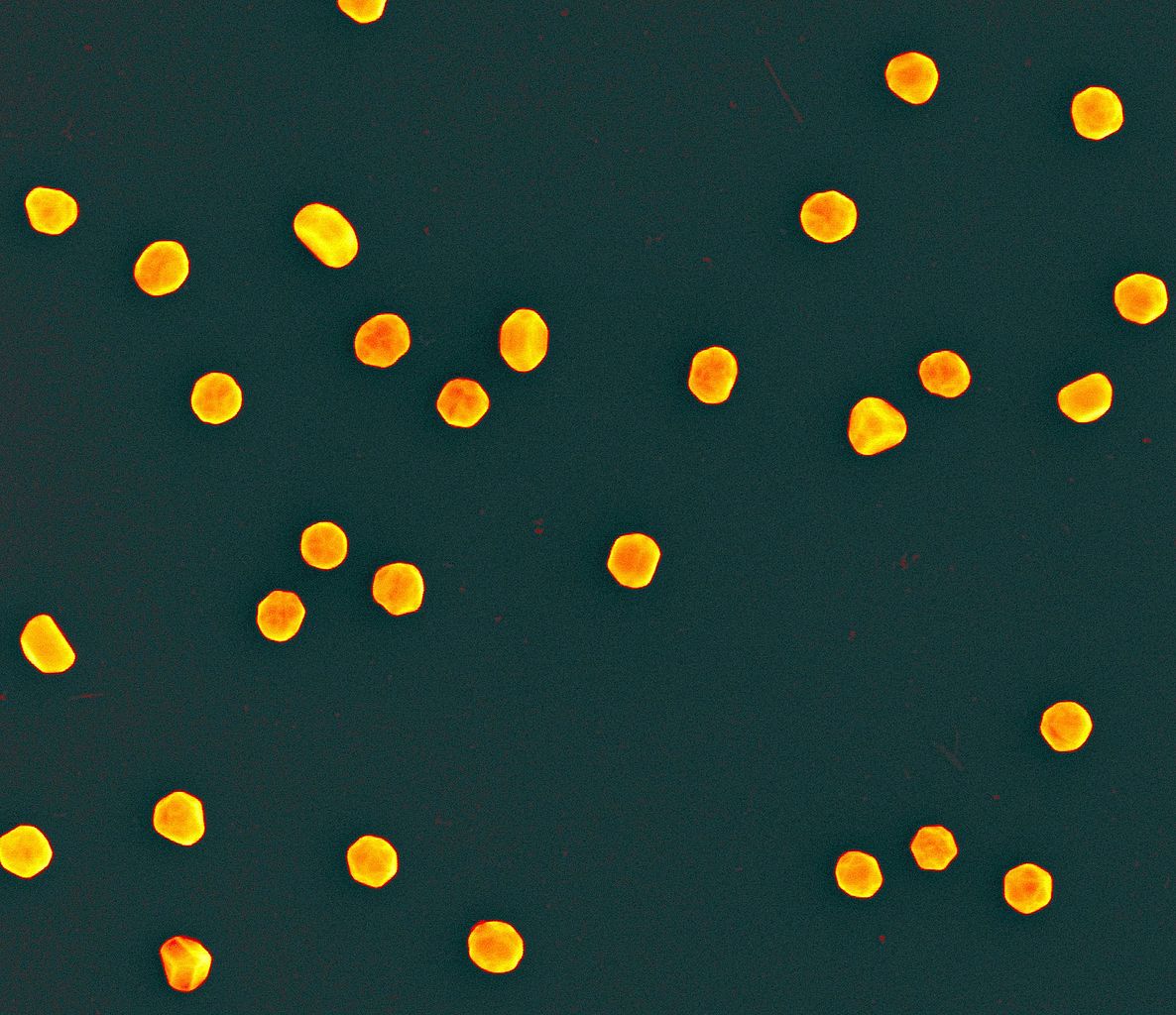 False color scanning electron micrograph showing gold nanoparticles