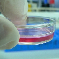 Cell culture in a Petri dish